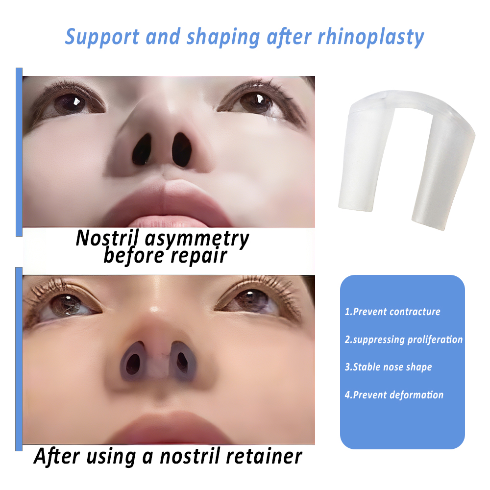 Nostril Retainer For Post-Rhin - Anti Snore Contour Pillow ulasan dan harga